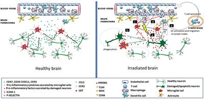 Ionizing Radiation-Induced Immune and Inflammatory Reactions in the Brain